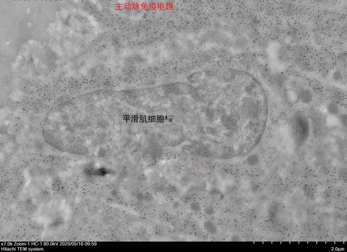 免疫电镜全套