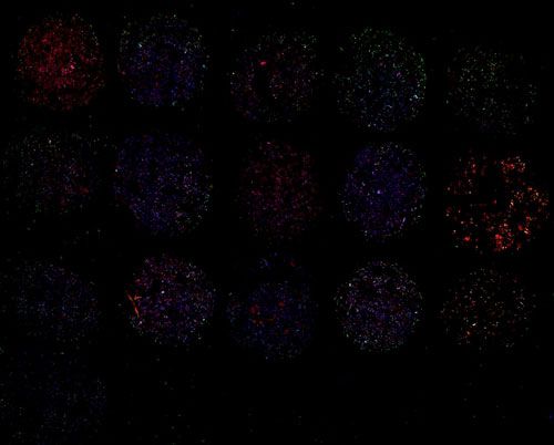 免疫荧光（双标，细胞芯片）