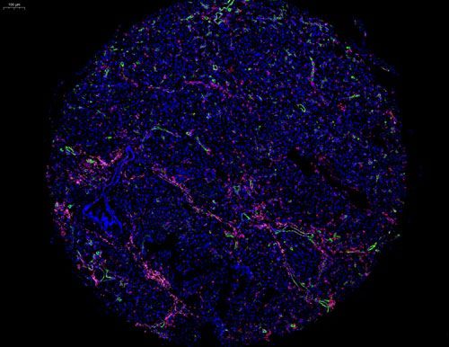 组织芯片扫描（荧光三标 四色）