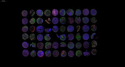 组织芯片扫描（荧光三标 四色）