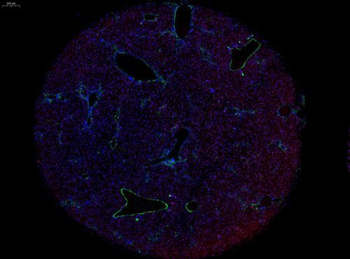 组织芯片扫描（荧光双标 三色）
