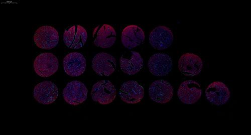 组织芯片扫描（荧光双标 三色）