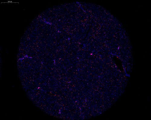组织芯片扫描（荧光单标 双色）