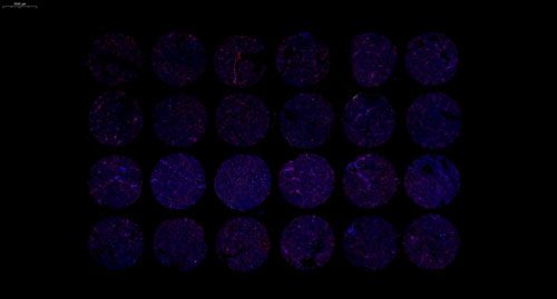 组织芯片扫描（荧光单标 双色）