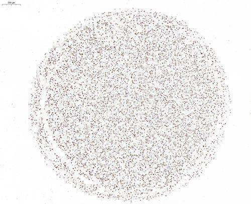 细胞芯片ICC检测+扫描分析