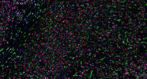 普通切片扫描（荧光三标 四色）