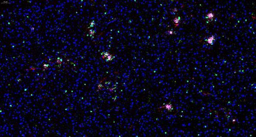 普通切片扫描（荧光三标 四色）