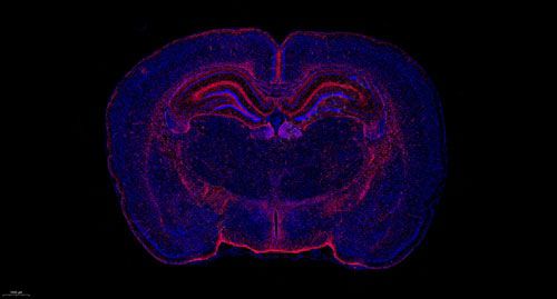 普通切片扫描（荧光单标 双色）
