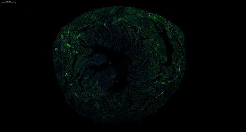 普通切片扫描（荧光单标 双色）