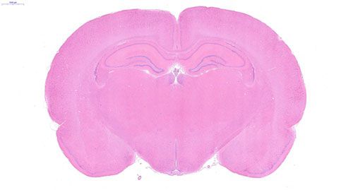 普通切片扫描(白光)