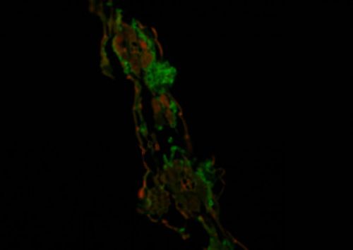 植物真菌染色-WGA