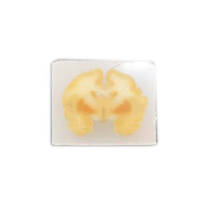 大组织大蜡块包埋（3.5cm*5cm）