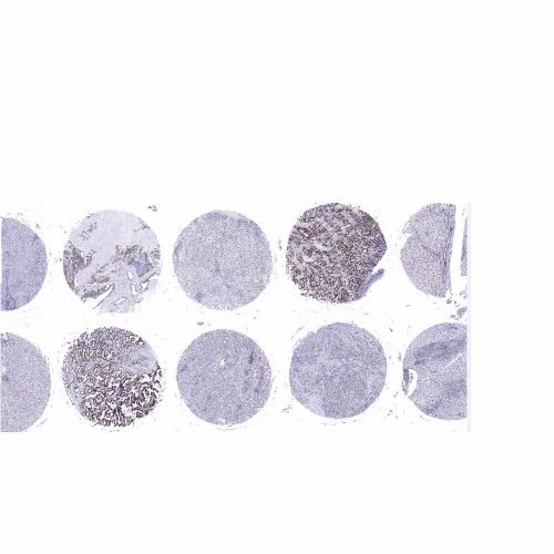 组织芯片蜡块制作